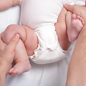 Профилактика дисплазии тазобедренных суставов у детей